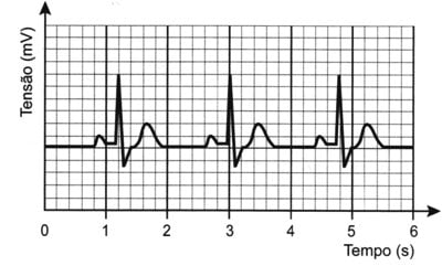 Enem 2016 cobra questão sobre frequência cardiáca